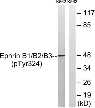 Ephrin-B1/2/3 (phospho-Tyr324) antibody