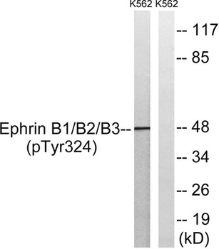 Ephrin-B1/2/3 (phospho Tyr324) rabbit pAb