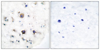 Ephrin-B3 antibody