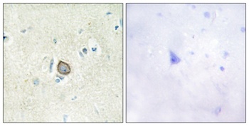 CDHF11 antibody