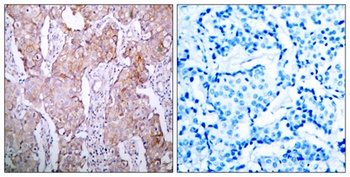 EGFR (phospho Ser1070) rabbit pAb