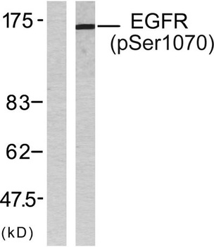 EGFR (phospho Ser1070) rabbit pAb