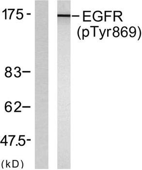 EGFR (phospho Tyr869) rabbit pAb