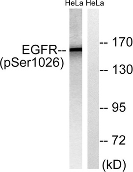 EGFR (phospho Ser1026) rabbit pAb