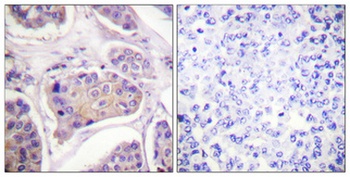 EGFR (phospho Tyr1016) rabbit pAb