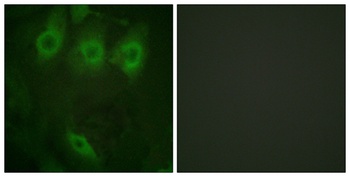 EGFR (phospho Tyr1016) rabbit pAb