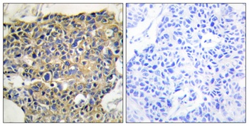 EGFR (phospho Tyr1016) rabbit pAb