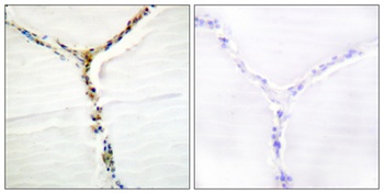 Ah Receptor (phospho Ser36) rabbit pAb
