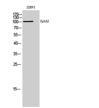 EphA2 rabbit pAb Antibody