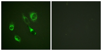 EphA2/3/4 (phospho-Tyr588/596) antibody