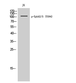 EphA2/5 (phospho Tyr594) rabbit pAb