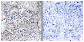 4E-BP1 (phospho-Thr46) antibody