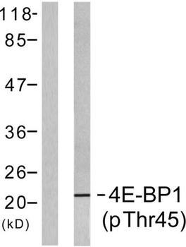 4E-BP1 (phospho Thr46) rabbit pAb