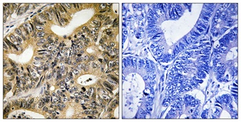 4E-BP1 (phospho Thr70) rabbit pAb