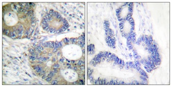 4E-BP1 rabbit pAb Antibody