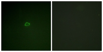 4E-BP1 rabbit pAb Antibody
