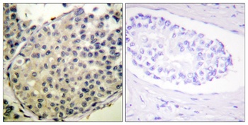 eIF4G (phospho Ser1148) rabbit pAb