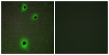 IGSF4C antibody