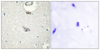 IGSF4C antibody