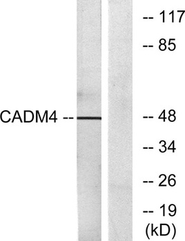 IGSF4C antibody