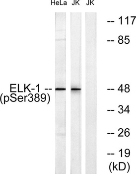 Elk-1 (phospho-Ser389) antibody