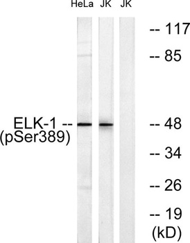 Elk-1 (phospho Ser389) rabbit pAb