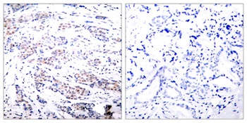 Elk-1 rabbit pAb