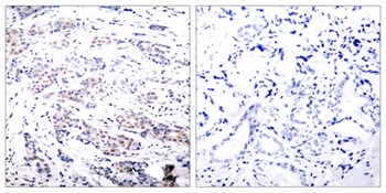 Elk-1 antibody