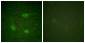 Net (phospho Ser357) rabbit pAb