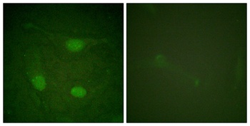 Net (phospho-Ser357) antibody