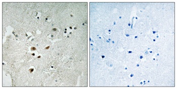 Net (phospho Ser357) rabbit pAb