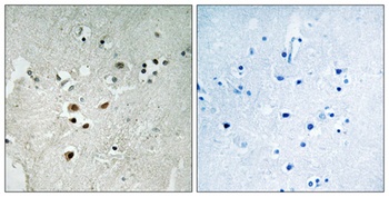 Net (phospho-Ser357) antibody