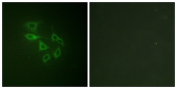 PIP5KIII (phospho Ser307) rabbit pAb