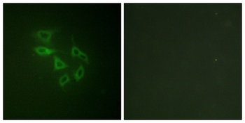 PIP5KIII (phospho-Ser307) antibody