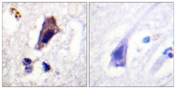 PIP5KIII (phospho Ser307) rabbit pAb
