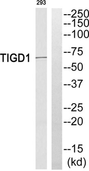 TIGD1 antibody