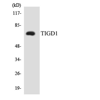 TIGD1 antibody