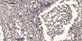 TIGD1 antibody