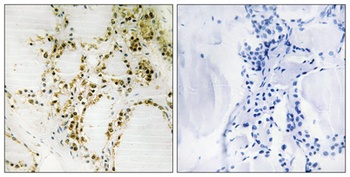 p300 (phospho Ser89) rabbit pAb