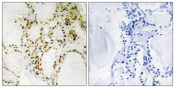 p300 (phospho-Ser89) antibody