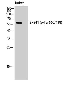 4.1R (phospho-Tyr660) antibody