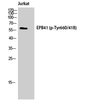 4.1R (phospho Tyr660) rabbit pAb