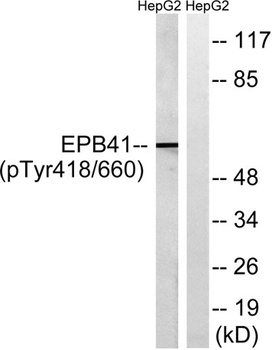 4.1R (phospho Tyr660) rabbit pAb