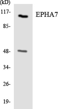 EphA7 antibody