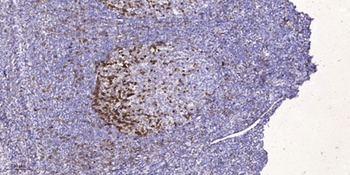 EphA7 rabbit pAb