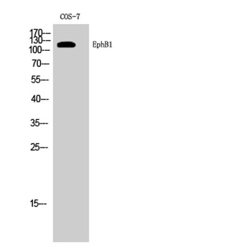 EphB1 rabbit pAb Antibody