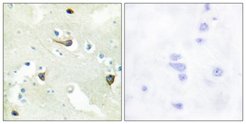 EphB1/2/3 antibody