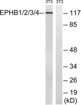 EphB1/2/3/4 rabbit pAb