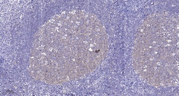 EphB1/2/3/4 antibody