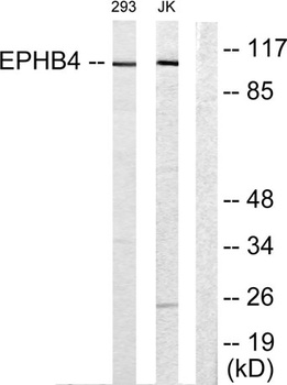 EphB4 rabbit pAb